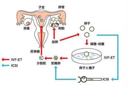 妊娠反应