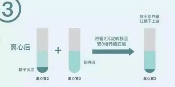 妊娠剧吐