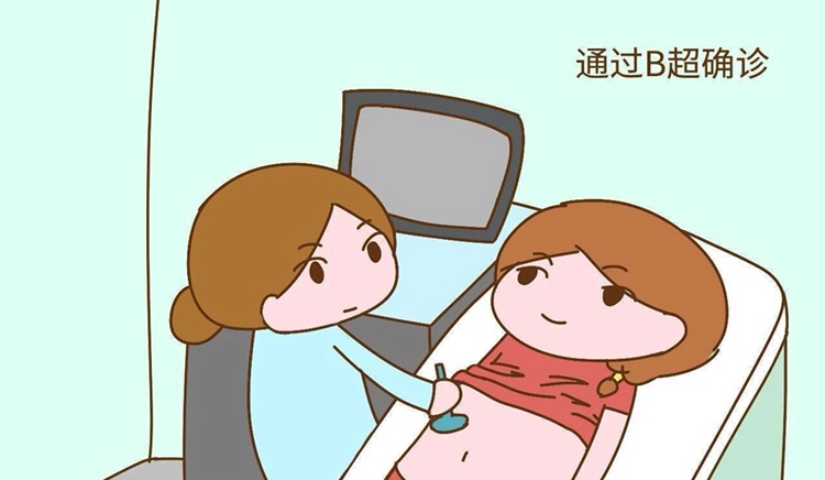 妊娠