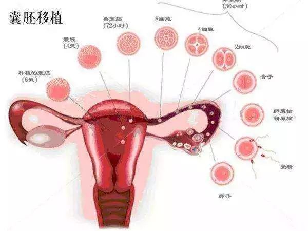 妊娠期糖尿病