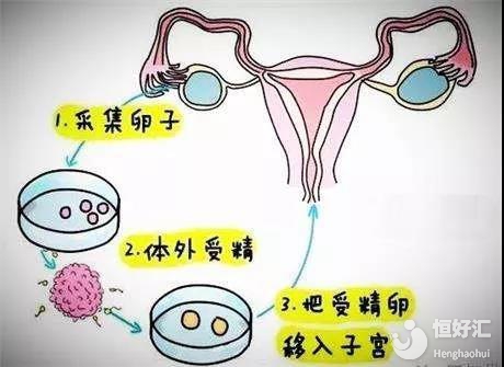 妊娠