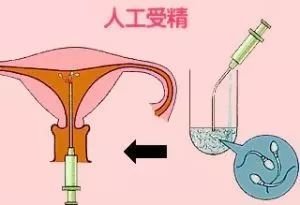 月经出血
