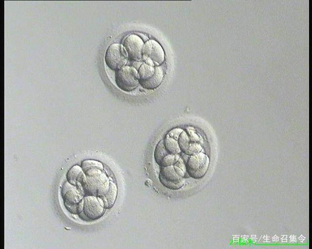 流产手术