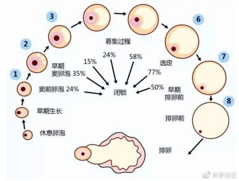 妊娠剧吐