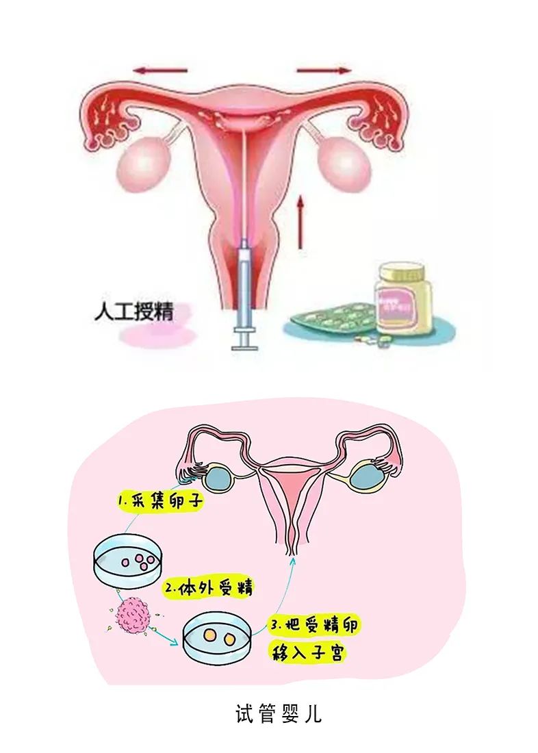 新生儿黄疸