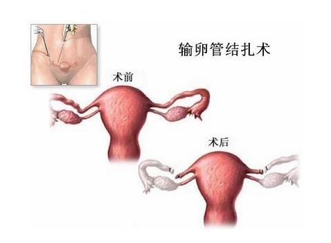 孕周数