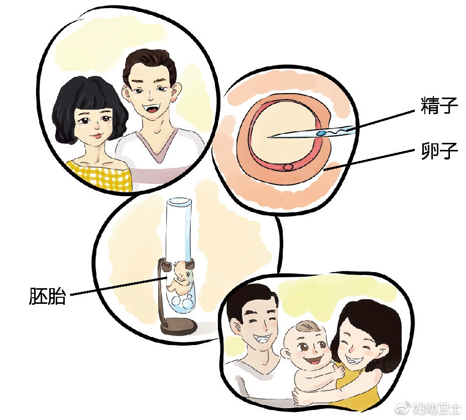 广元捐卵公司