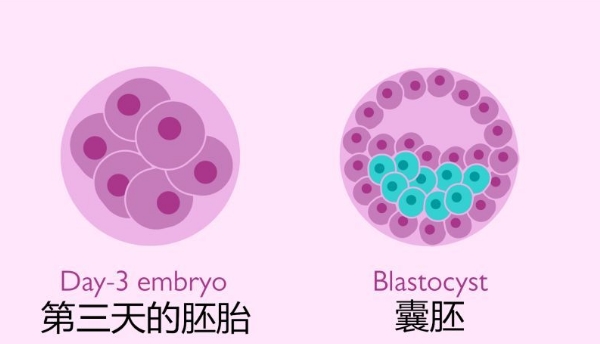 广州三代试管包生男孩