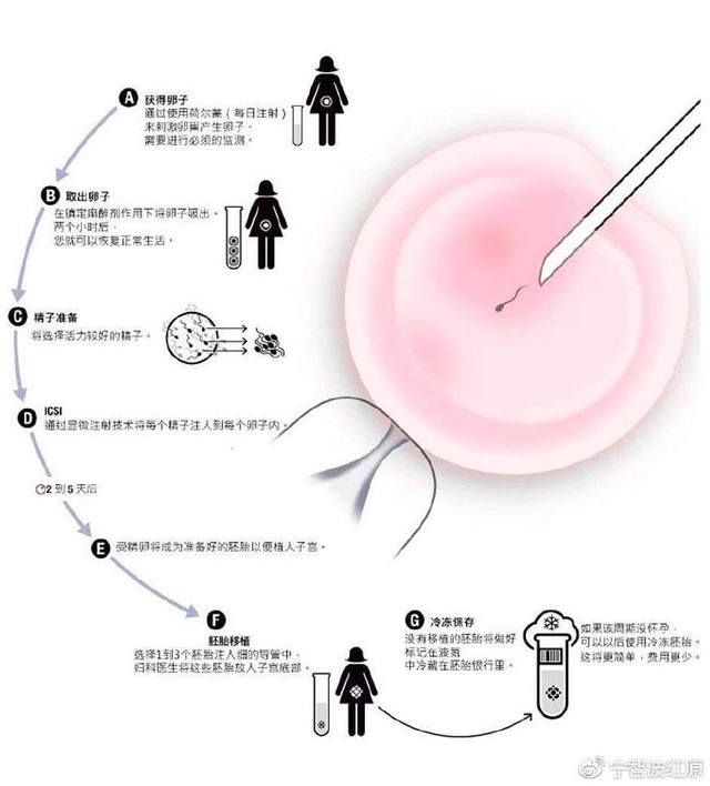 广州供卵私立医院排名