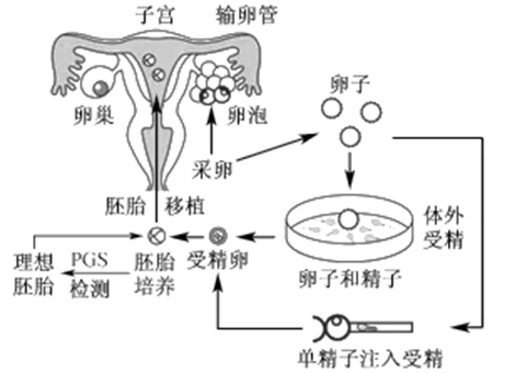 广元捐卵代怀生子