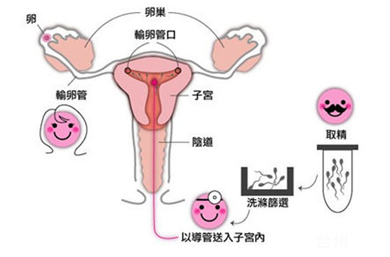 广元捐卵咨询