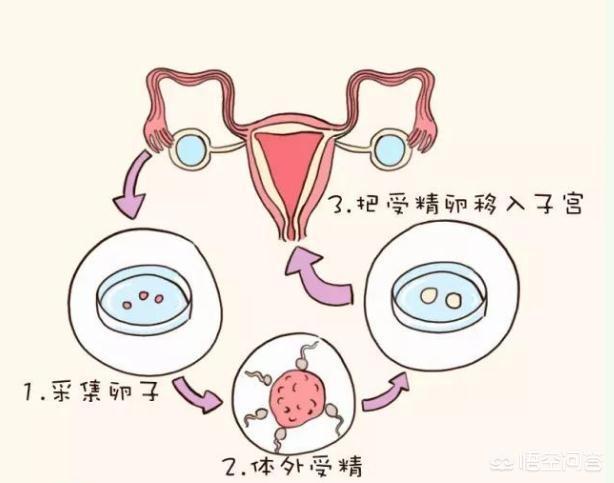 广州捐卵公司